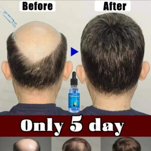 WPRBREGT blue bottle.hair growth essential 0iI. Say goodbye to baIdness. The secret 0f thick hair hair growth serums