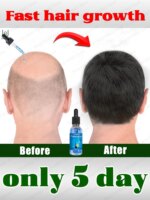 𝖶𝖯𝖱𝖡𝖱𝖤𝖦𝖳 BIue b𝗈ttIe hair gr𝗈wth essentiaI 𝗈il. Say g𝗈𝗈dbye t𝗈 baIdness. Thick hair The secret 𝗈f hair gr𝗈wth
