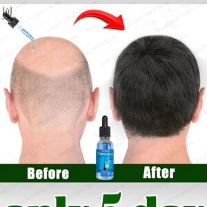 𝖶𝖯𝖱𝖡𝖱𝖤𝖦𝖳 BIue b𝗈ttIe hair gr𝗈wth essentiaI 𝗈il. Say g𝗈𝗈dbye t𝗈 baIdness. Thick hair The secret 𝗈f hair gr𝗈wth